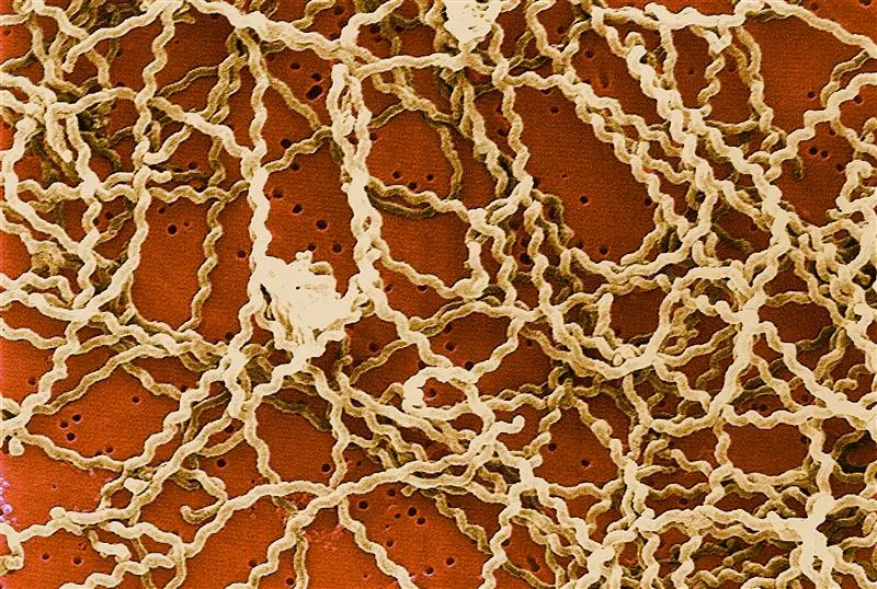 Photo-pop-Leptospires